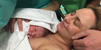 Mutter kuschelt mit Ihrem Kind im Kaiserschnitt-Op nach der Geburt